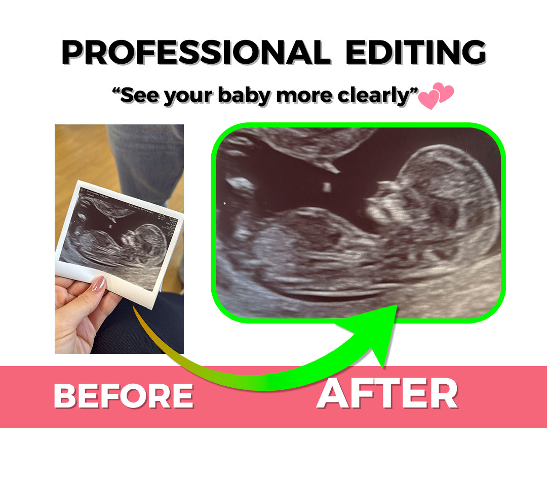 Quick Fix: Enhanced Baby Ultrasound